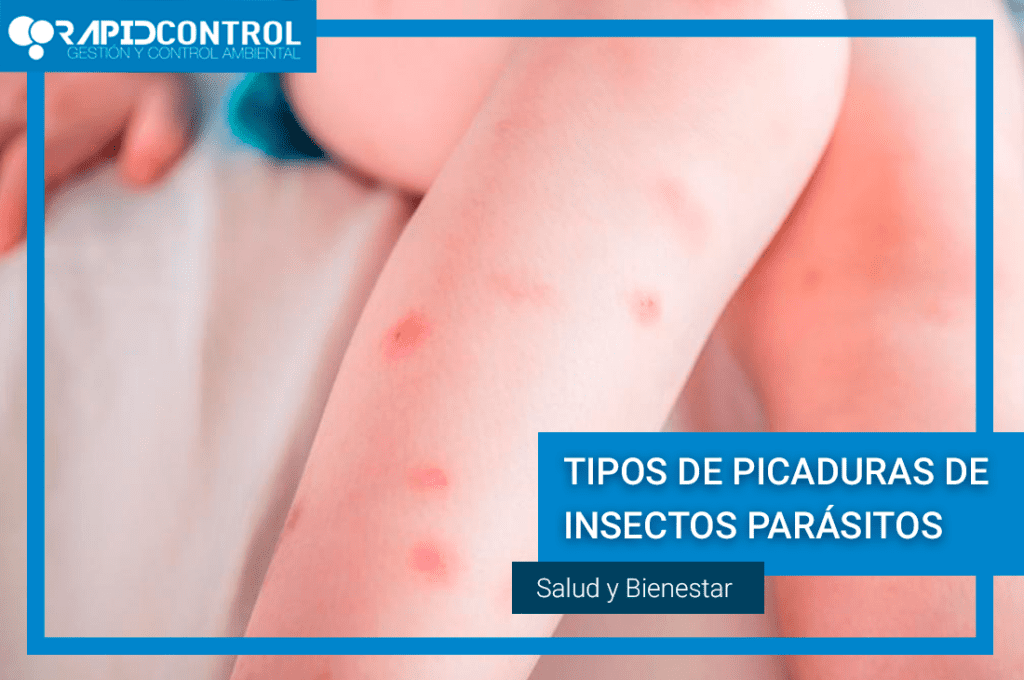 PICADURAS-INSECTOS