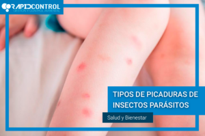 PICADURAS-INSECTOS